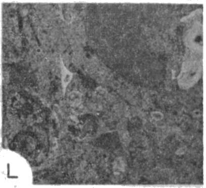 photomicrograph 1l