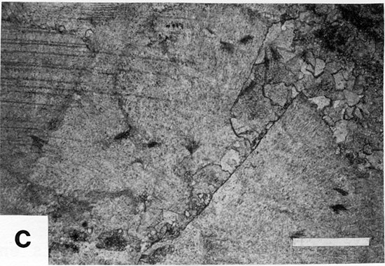 Black and white photomicrograph.