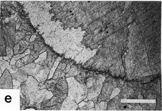 Black and white photomicrograph.