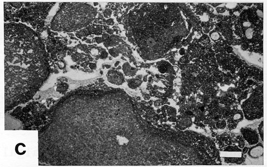 Black and white photomicrograph.