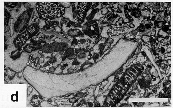 Black and white photomicrograph.