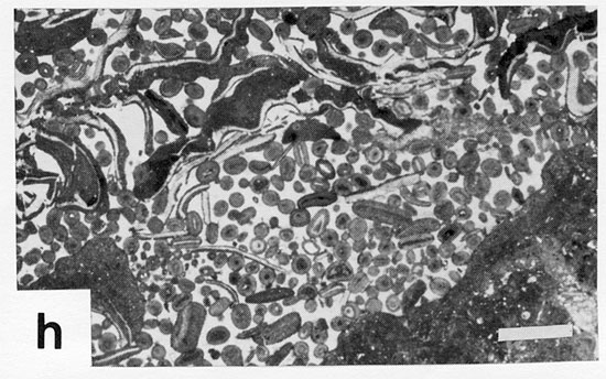 Black and white photomicrograph.