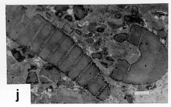 Black and white photomicrograph.