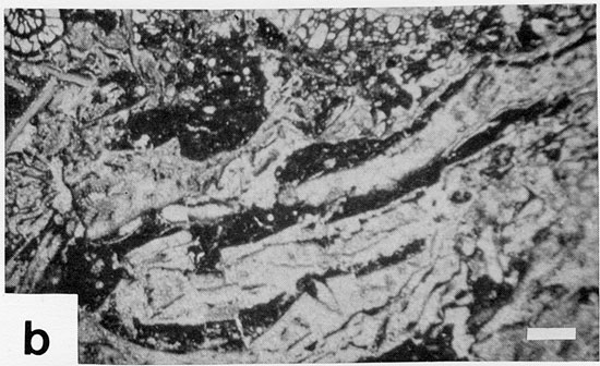 Black and white photomicrograph.