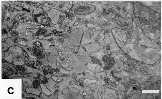 Black and white photomicrograph.