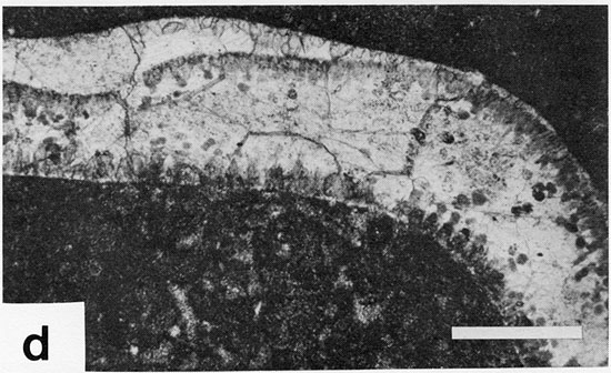 Black and white photomicrograph.