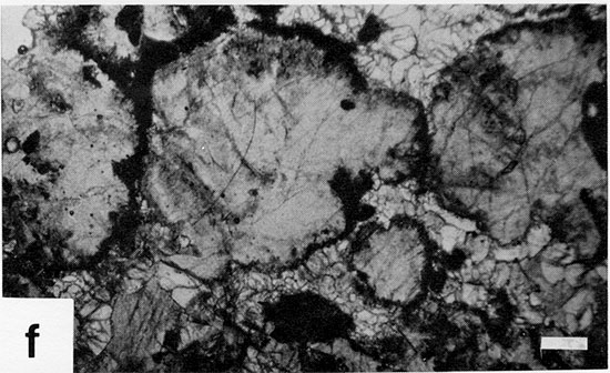 Black and white photomicrograph.