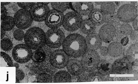 Black and white photomicrograph.