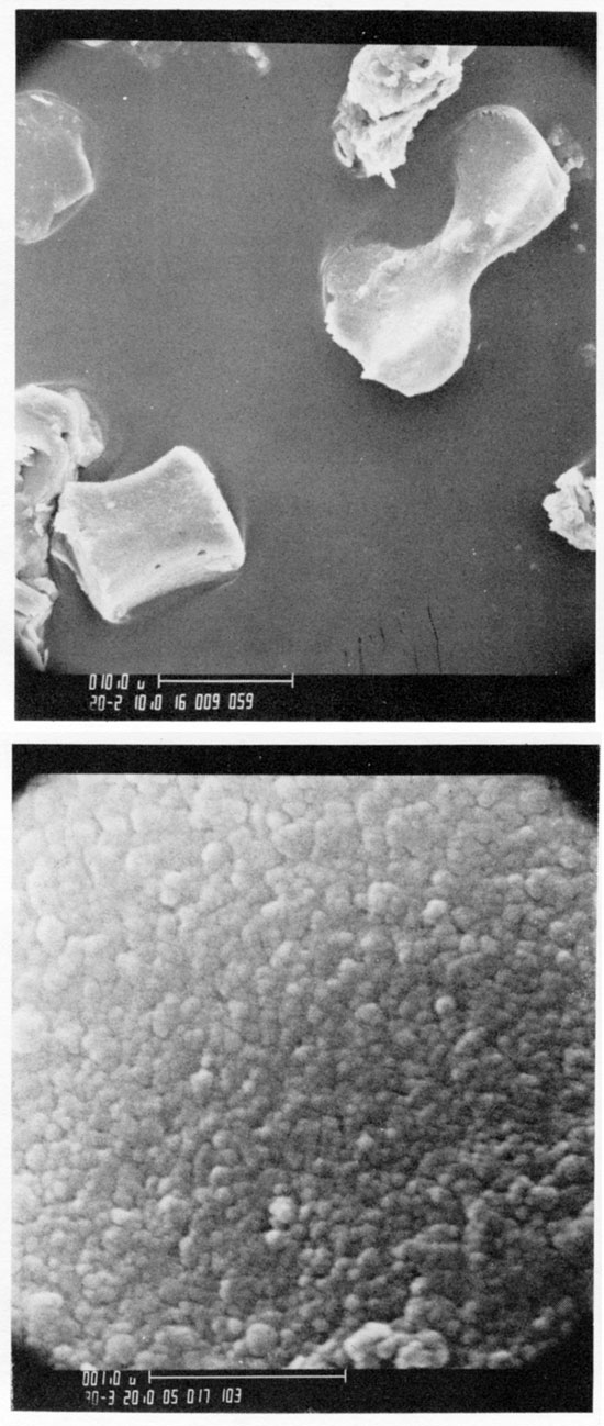 Two black and white scanning-electron microscope photos of grass phytoliths.