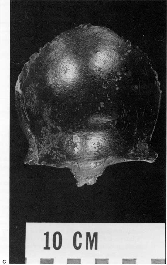Black and white photo of Homo sapiens skull cap.