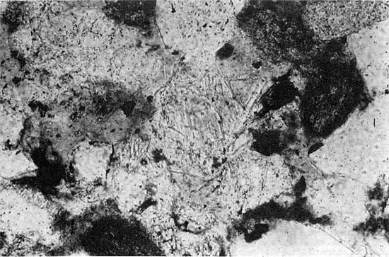 Black and white photomicrograph.