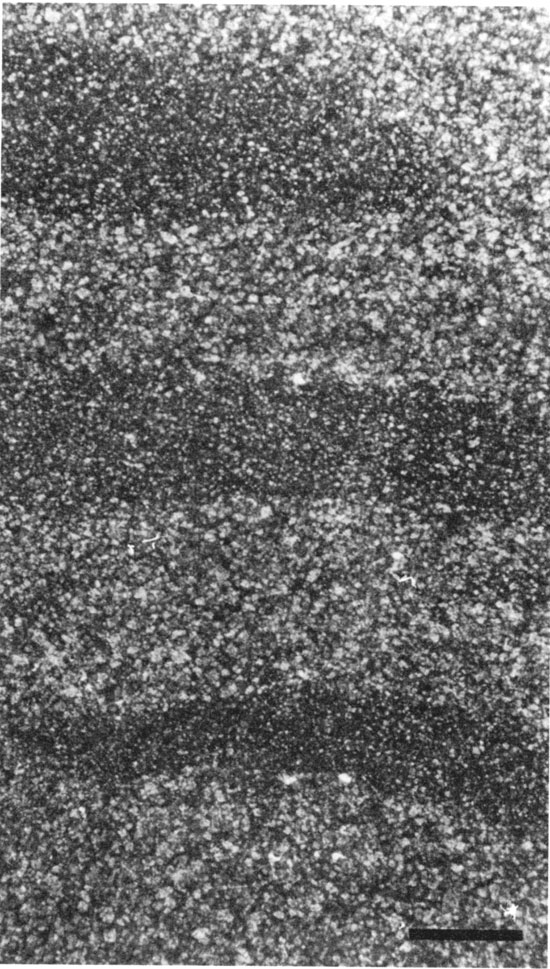 Black and white photomicrograph of dolomitic intraclast wackestone facies.