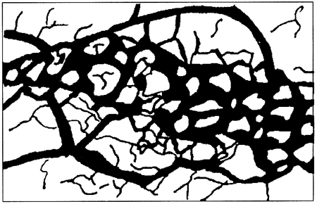 Drawing showing network of thin and thick black bands; connecting and diverging across white background.