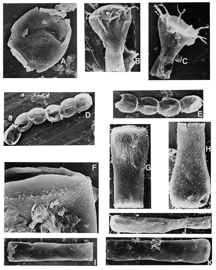 Black and white scanning electron micrographs of chitinozoans.