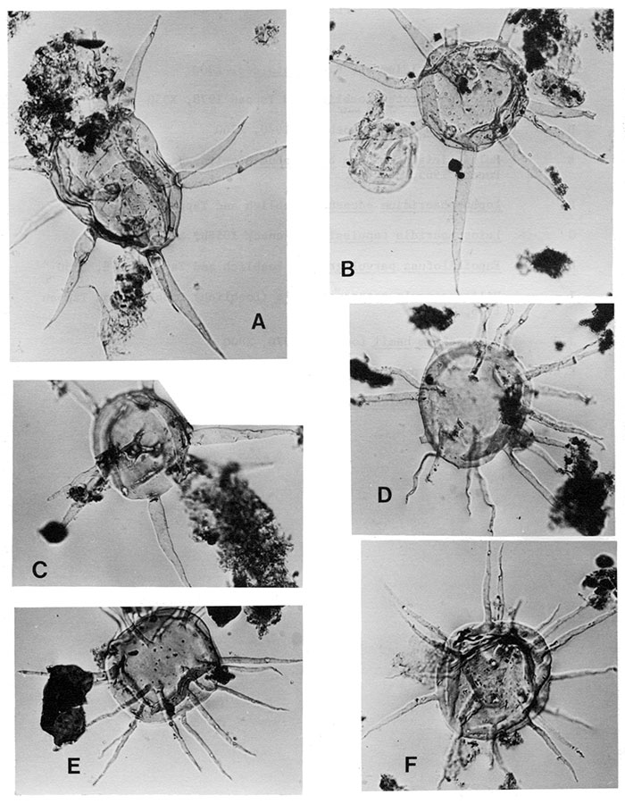 Black and white transmitted light micrographs of acritarchs.