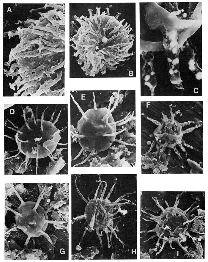 Black and white scanning electron micrographs of acritarchs.