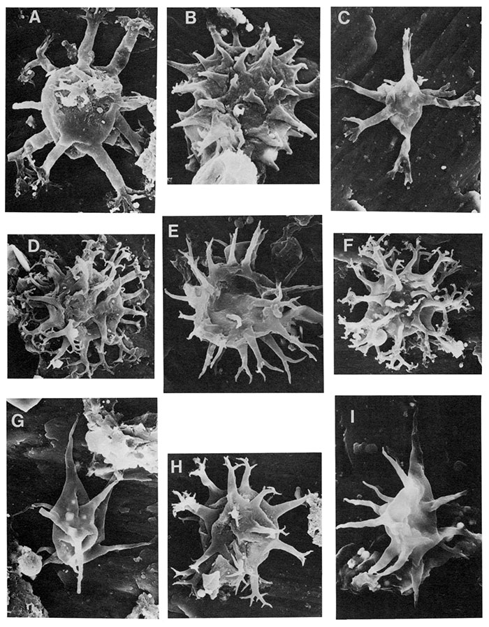 Black and white scanning electron micrographs of acritarchs.