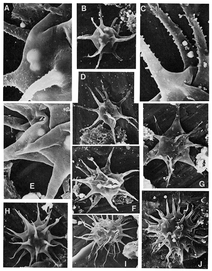 Black and white scanning electron micrographs of acritarchs.