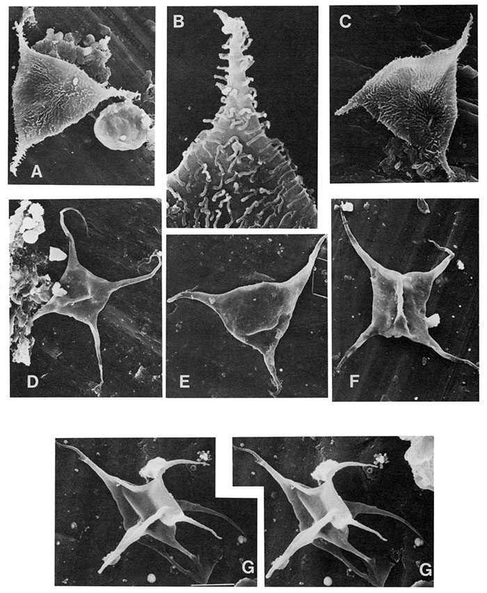 Black and white scanning electron micrographs of acritarchs.