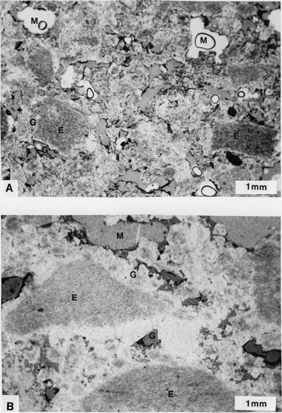 Two black and white photomicrographs.