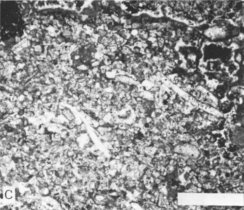 Black and white photomicrograph of core.