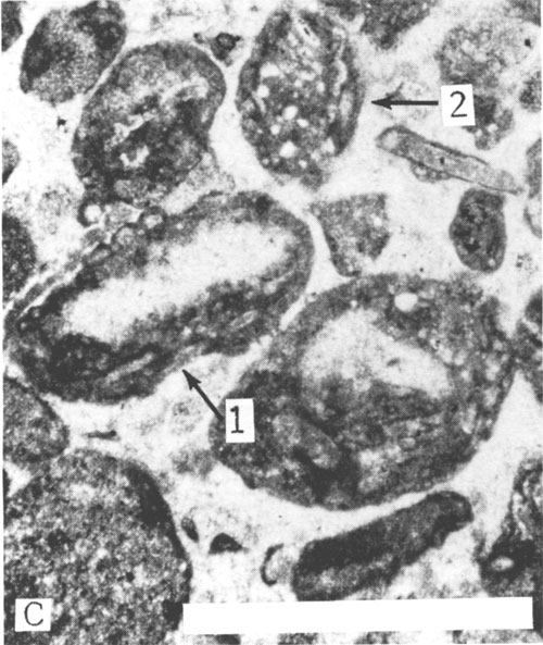 Black and white photomicrograph of core.