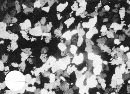 Black and white photomicrograph.