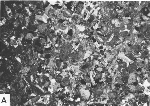 Black and white photomicrograph.