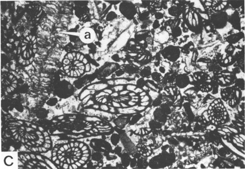 Black and white photomicrograph.